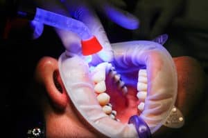 Dental work - hypnotherapy training for healthcare professionals