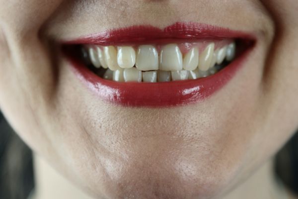 Masked hypnotherapist - woman with red lipstick showing an open smile. 